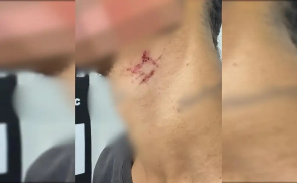 Homem vítima de estupro e tortura